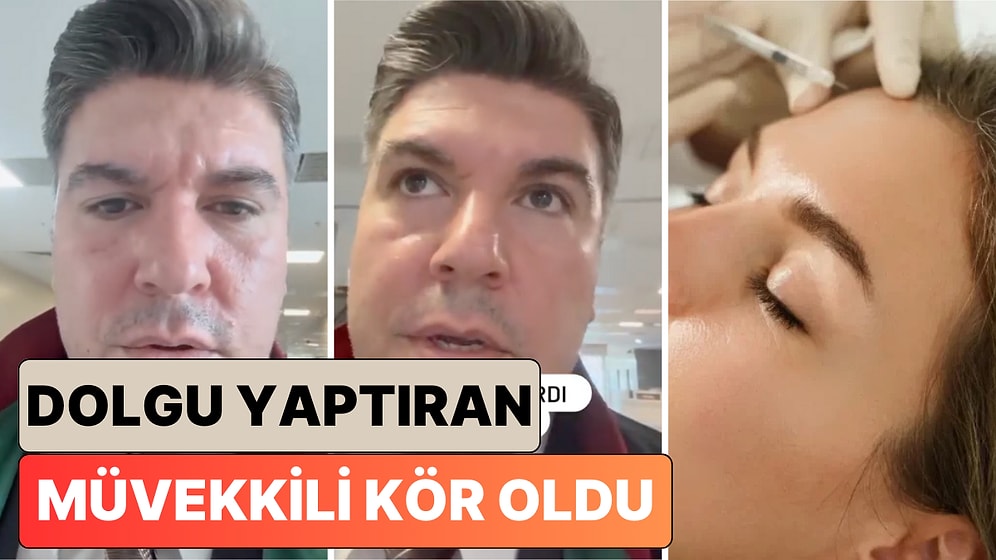 Bir Avukat Yaptırdığı Dolgunun Ardından Kör Olan Müvekkilinin Ardından İnsanları Uyardı