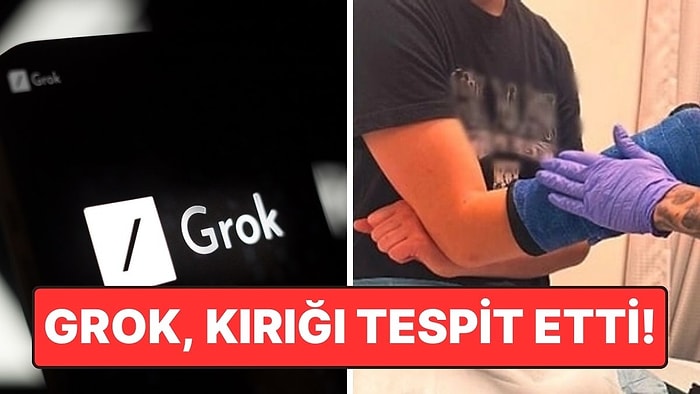 X'in Yapay Zekası Grok Doktorların Gözden Kaçırdığı Kırığı Tespit Etti