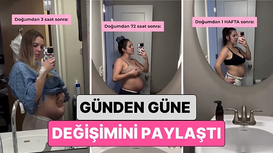 Yeni Doğum Yapan Bir Kadın Göbeğinin Günden Güne Değişimini Paylaştı