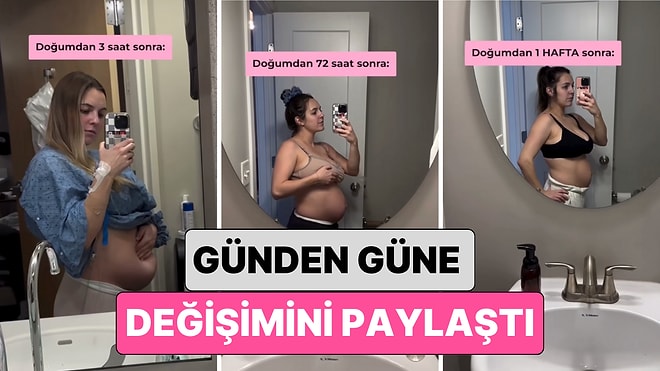 Yeni Doğum Yapan Bir Kadın Göbeğinin Günden Güne Değişimini Paylaştı