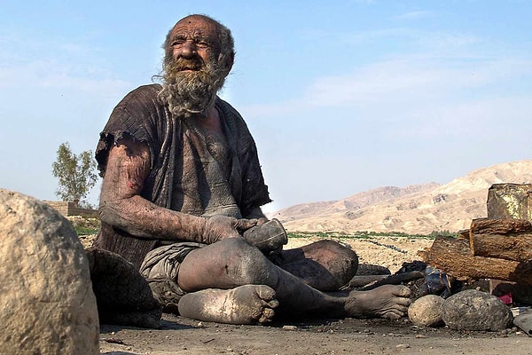 94 yaşındaki İranlı Amou Haji, "dünyanın en kirli adamı" unvanıyla tanınıyordu. Tam 50 yıl boyunca suya ve sabuna dokunmayan Haji, yıkanmanın kendisini hasta edeceğine inanıyordu.