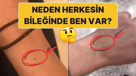 Sizde de Olabilir! Neden Çoğu İnsanın Bileğinde Aynı Benden Var?