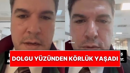 Bir Avukat Müvekkilinin Kaş Arasına Yaptırdığı Dolgu Sebebiyle Görme Kaybı Yaşadığını Anlatarak Uyardı