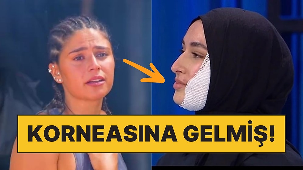 MasterChef Beyza'dan Sonra Bir Kaza da Survivor'da: Ayşe'nin Gözüne Kızgın Yağ Sıçradı!