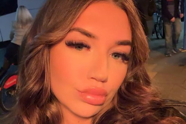 Dolgu işlemini bir Instagram hesabı üzerinden bulduğu, pek de profesyonel olmayan birine yaptırıyor. Kadın, bu kişinin tıbbi bir geçmişi olmadığını biliyor ama daha önce arkadaşlarına da dolgu yapmış ve bir sorun çıkmamış. Hatta bu kişi yılbaşı için özel kampanyalar yapıyormuş, o yüzden “Tamam, bu sefer de sorun olmaz” diye düşünüp dolgu yaptırıyor.