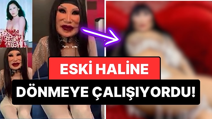 Yüzüne Yemeklik Yağ Enjekte Edildiği İçin Hayatı Cehenneme Dönen Oyuncunun Son Hali Şaşırttı