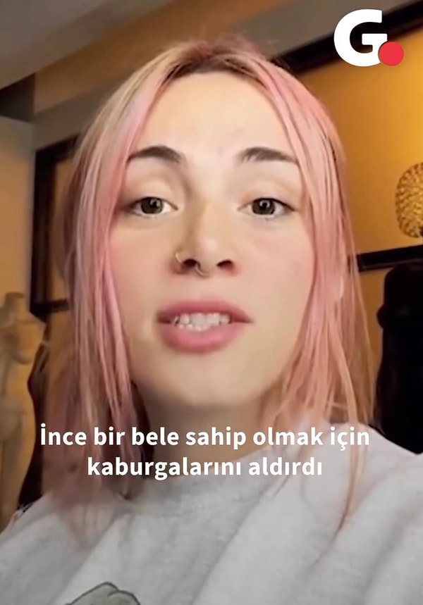 27 yaşındaki Emily James daha ince bir bele sahip olmak için 6 adet kaburga kemiğini aldırdı.