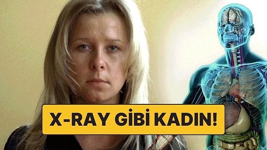 Tıpkı X-Ray Gibi İnsanların İç Organlarını Gördüğünü İddia Eden Kadın: Natasha Demkina