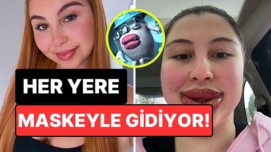 Kalıcı Makyaj Yaptırmak İsterken Alerjik Reaksiyon Geçirip Bambaşka Birine Dönüşen Kadın