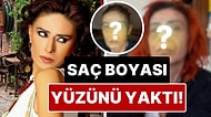 Yüzünün Hali Şoka Soktu: Yıldız Tilbe'nin Suratında Saç Boyası Yüzünden Kimyasal Yanıklar Oluştu!
