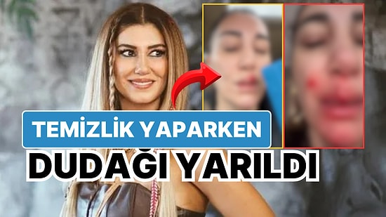 Nadide Sultan Evinde Temizlik Yaparken Kaza Geçirdi! Sağlık Durumunu Sosyal Medyadan Açıkladı