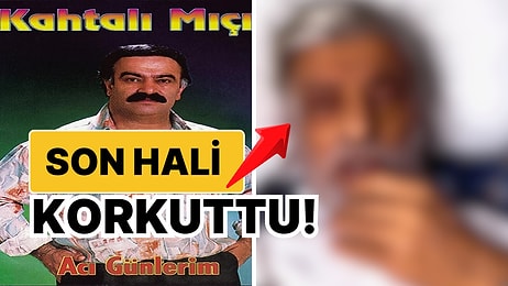 Kemoterapi Gören Kahtalı Mıçe’nin Hasta Yatağındaki Son Hali Sevenlerini Korkuttu!