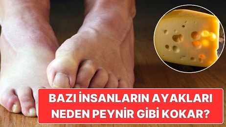 Neden Bazı İnsanların Ayakları Resmen Peynir Fabrikası Gibi Kokar?