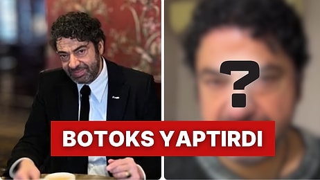 Dört Sene Önce Sağlık Sorunlarıyla Gündeme Gelen Şarkıcı Hakan Taşıyan Botoks Yaptırmasıyla Gündeme Geldi