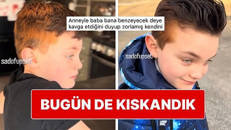 Doğuştan İki Saç Rengine Sahip Olan Yakışıklı mı Yakışıklı Çocuk Sosyal Medyada Viral Oldu