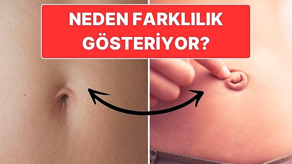 7. Göbek Deliğinizin Şeklini Hiç Merak Ettiniz mi? Şekillerinin Farklı Olmasının Şaşırtan Bir Sebebi Var!