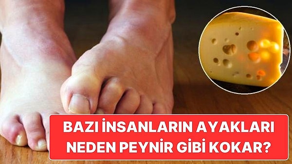 11. Bilimsel Açıklaması Var! Neden Bazı İnsanların Ayakları Resmen Peynir Fabrikası Gibi Kokar?