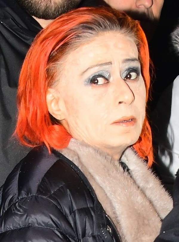 Yıldız Tilbe: