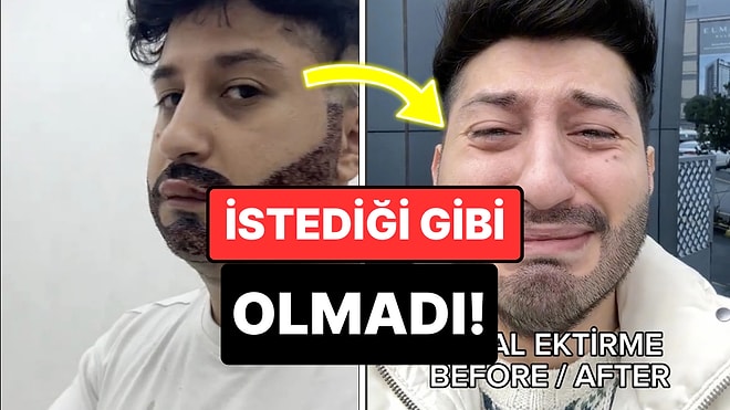 Sakal Ektirdi Ama Sonuç Kabus Gibi Oldu: Yaşadığı Pişmanlığı Gözyaşları İçinde Anlattı!