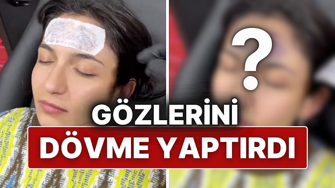 Cumhurbaşkanı Erdoğan’a Olan Sevgisini Farklı Bir Yolla Gösterdi: Alnına Gözlerini Dövme Yaptırdı