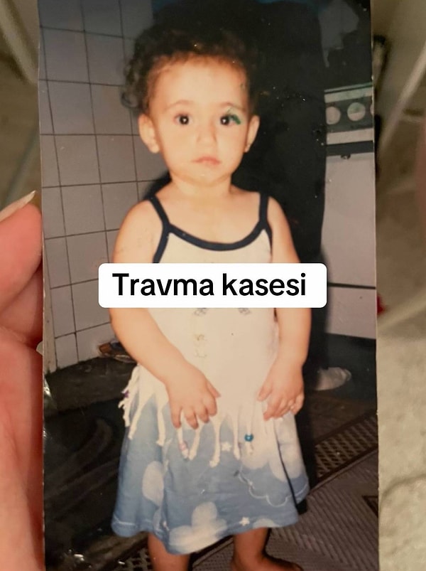 Geçtiğimiz sene "travma kasesi" notunu düştüğü bir çocukluk fotoğrafını TikTok'ta paylaşan 24 yaşındaki genç kadın, başından geçen korkunç olayları anlatmıştı.