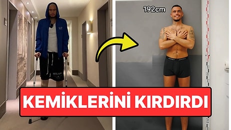 Lisede Boyundan Dolayı Zorbalandığı İçin Boy Uzatma Ameliyatına Girerek 20 Cm Uzayan Adam