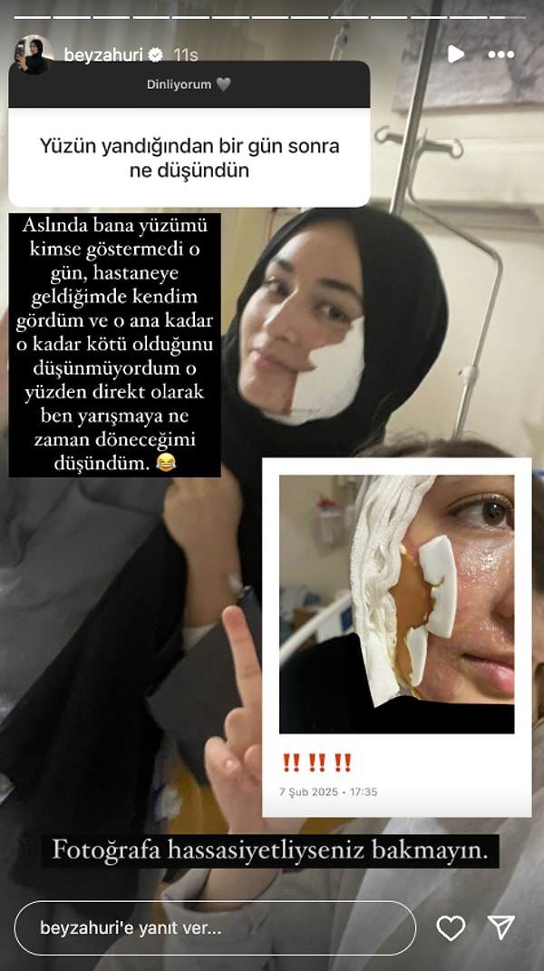 "O yüzden direkt olarak ben yarışmaya ne zaman döneceğimi düşündüm."