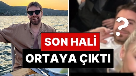 Burnunun Ucu Yok Olmuştu: 11 Kez Burnudan Ameliyat Geçiren Murat Dalkılıç'ın Son Hali Ortaya Çıktı!