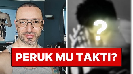 Saçlarını Kazıtarak Görenlere Ufak Çaplı Bir Şok Yaşatan Mabel Matiz Bu Sefer de Peruk mu Taktı?