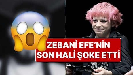 Zebani Efe Olarak Tanınan Efe Baycan’ın Son Halini Görenler Tanıyamadı!