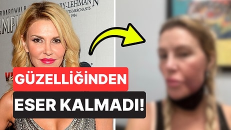 Yüzü Eridi! Bir Zamanların Ünlü Modelinin Son Açıklamaları Üzdü: "Acınası Haldeyim"