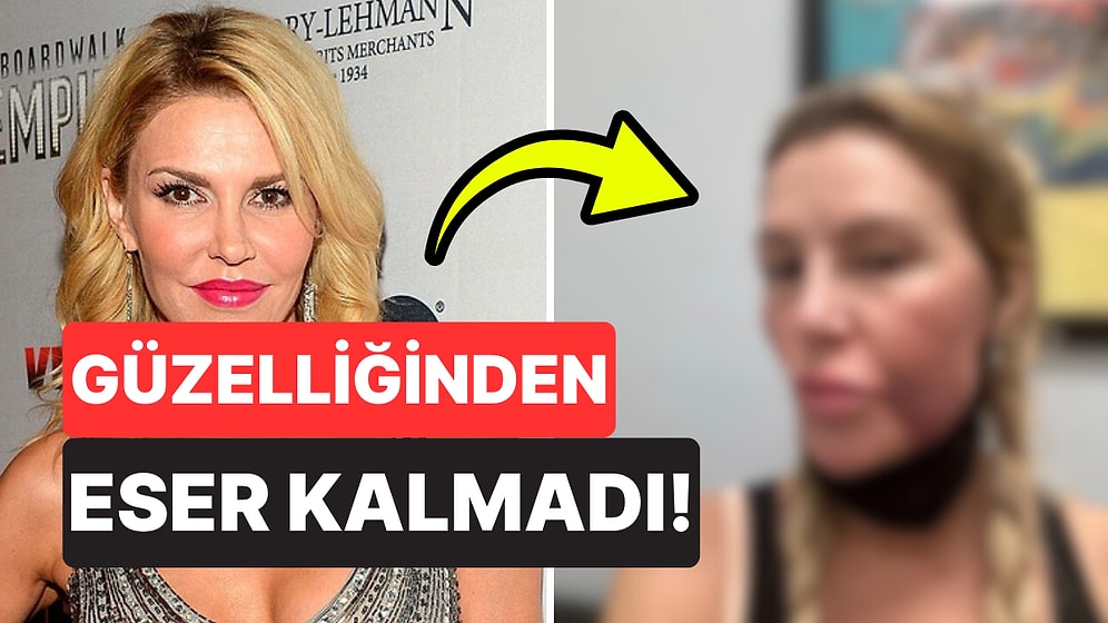 Yüzü Eridi! Bir Zamanların Ünlü Modelinin Son Açıklamaları Üzdü: "Acınası Haldeyim"