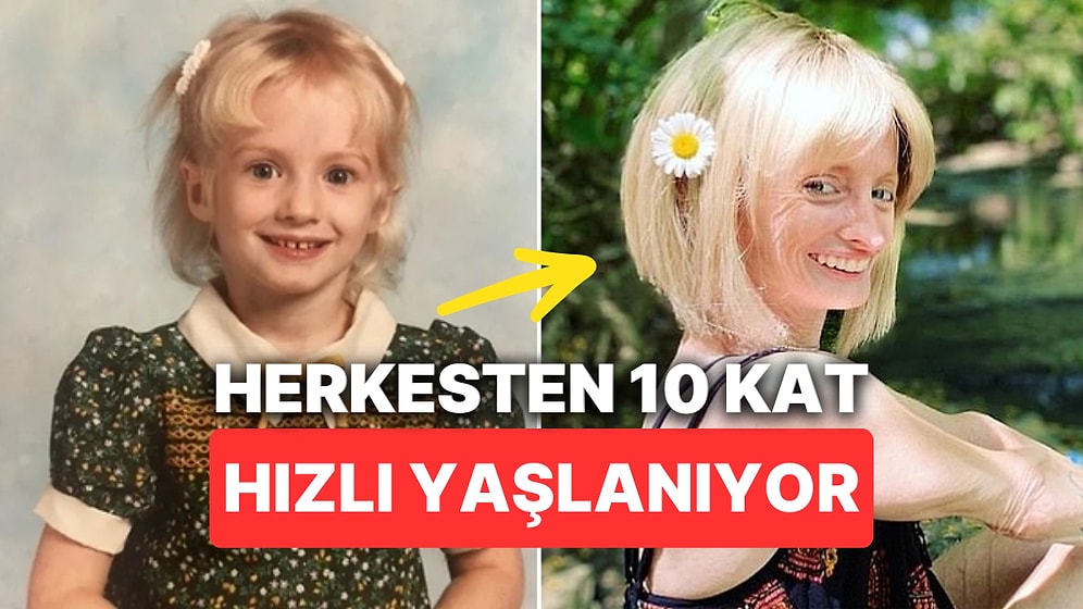Nadir Görülen Hastalığı Yüzünden Herkesten 10 Kat Daha Hızlı Yaşlanan Kadın