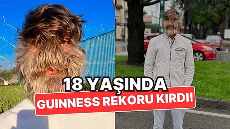 18 Yaşındaki Lalit Patidar, Dünyanın En Kıllı Yüzüne Sahip Olarak Guinness Rekorlar Kitabı'na Girdi!