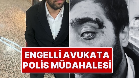 Ekrem İmamoğlu’na Destek Eyleminde Görme Engelli Avukat Polis Müdahalesinde Yaralandı