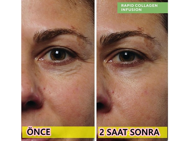 Murad Rapid Collagen Infusion Anında Sıkılaştırıcı Kolajen Serumu