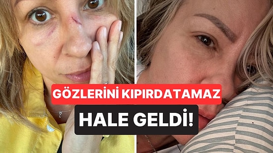 Soğuk Algınlığı Sandı, Gerçek Bambaşka Çıktı: İşitme Kaybı Yaşayarak Hayatı Baştan Aşağı Değişen Kadın