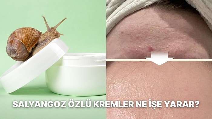 Son Dönemde Popüler Olan Salyangoz Özü Nedir, Kremi Ne İşe Yarar?