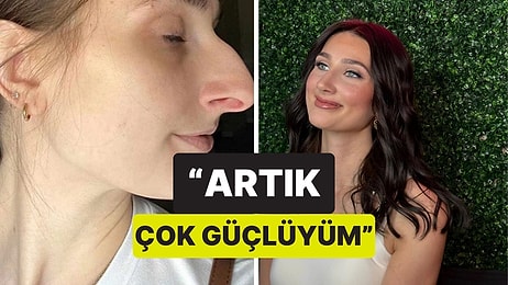 Burun Estetiği Olduktan Sonra Çok Güzel Olduğunu Fark Edip Kocasından Boşanan Kadın