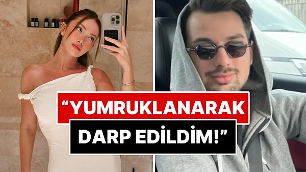 Kendisini Taciz Eden Berk Çetin'e Uzaklaştırma Kararı Alan Danla Bilic Eski Sevgilisi Tarafından Darp Edildi