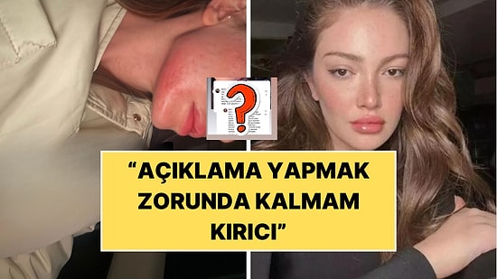 Danla Bilic Yara İzini Sorgulayan Kullanıcıya Cevap Verdi