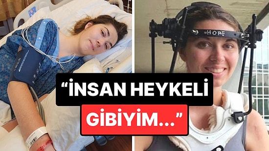 Kafası "Koptuktan" Sonra Cerrahi Müdahalelerle Hayata Tutunan Kadın O Süreci Anlattı