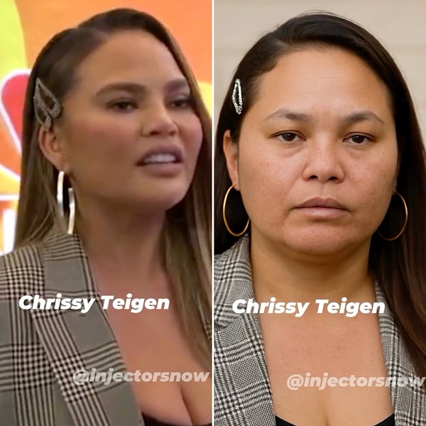 Chrissy Teigen