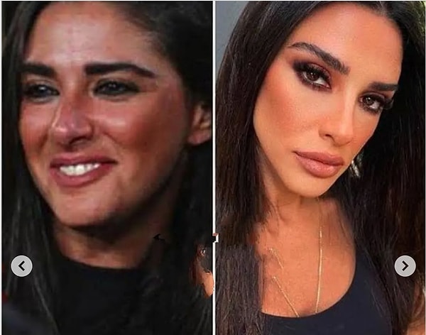 Marka iş birlikleri, evinin dekorasyonu, giyim tarzı derken her detayı merak edilen biri oldu. Ve elbette bu dönüşümün en çok konuşulan kısmı: geçirdiği estetik değişim.