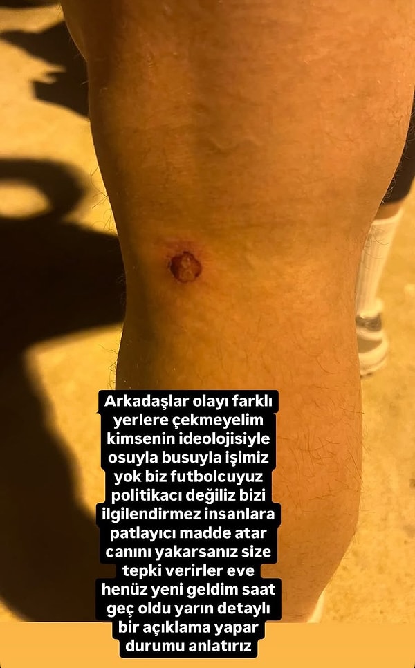 Burak Süleyman'ın açıklaması 👇