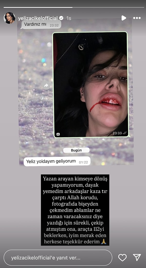 Geçirdiği trafik kazasının ardından yüzü kanlar içinde kalan bir fotoğrafını paylaşan Açıkel, “Yazan arayan kimseye dönüş yapamıyorum. Dayak yemedim arkadaşlar, tır çarptı. Allah korudu” diyerek açıklamada bulundu.