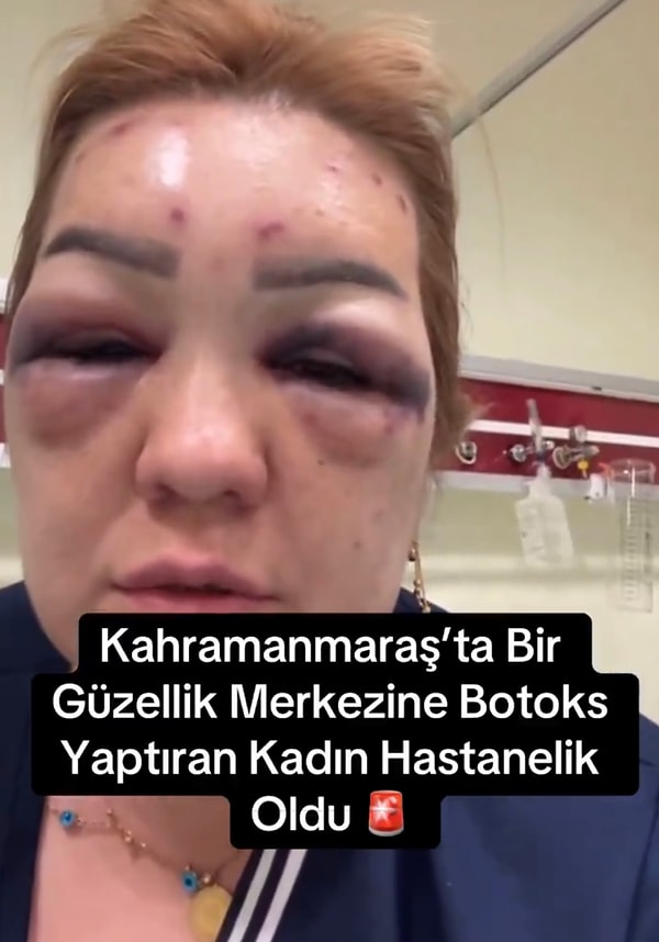 Çınar, daha önceki botoks işlemlerinde hep doktorları tercih ettiğini söyledi.