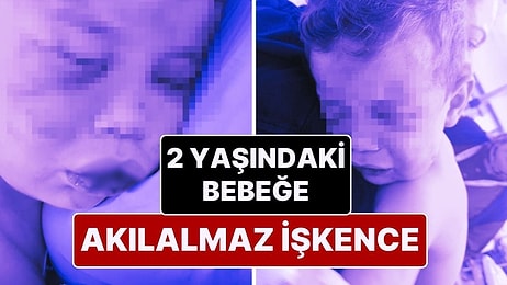 Denizli’de Kan Donduran Olay! 2 Yaşındaki Bebek Dövülerek Hastanelik Edildi