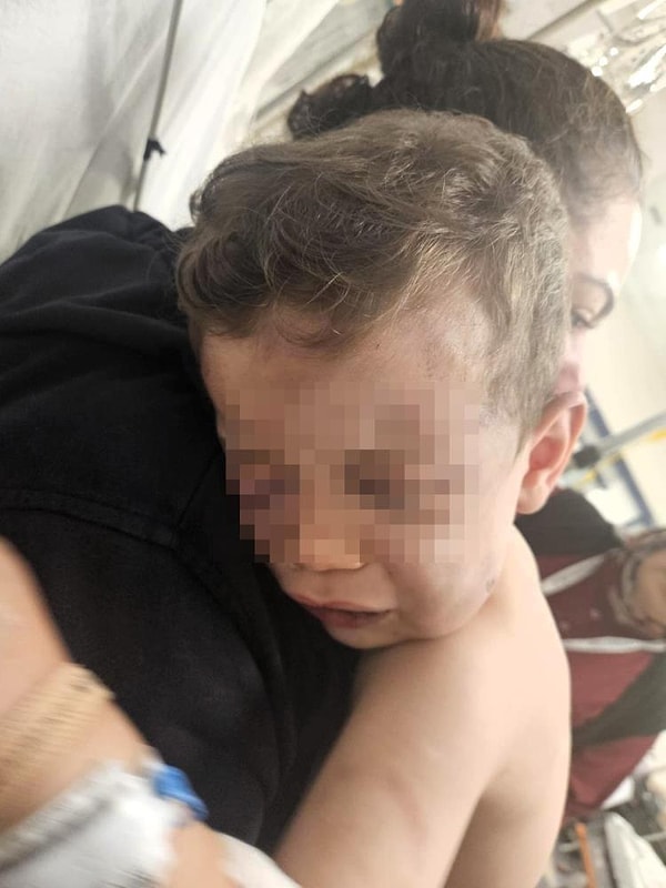 Aldığı darbeler nedeniyle başında travma oluşan Aren bebek, Sarayköy Devlet Hastanesi'nde yapılan ilk tedavisinin ardından devam eden hayati tehlikesi nedeniyle ambulansla Pamukkale Üniversitesi Hastanesine sevk edildi.