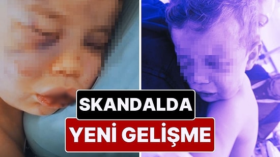2 Yaşındaki Aren Bebeği Hastanelik Eden Caniler Gözaltında: Aren'i Yakmaya Çalışmışlar!